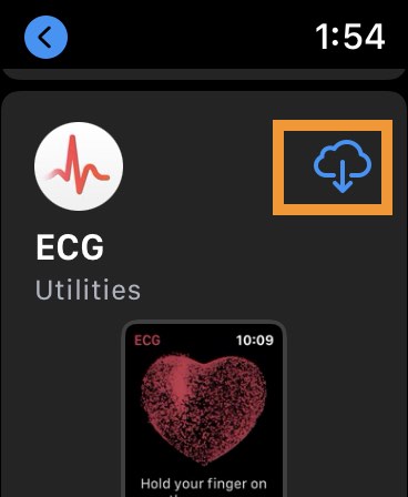 Download ECG app and install