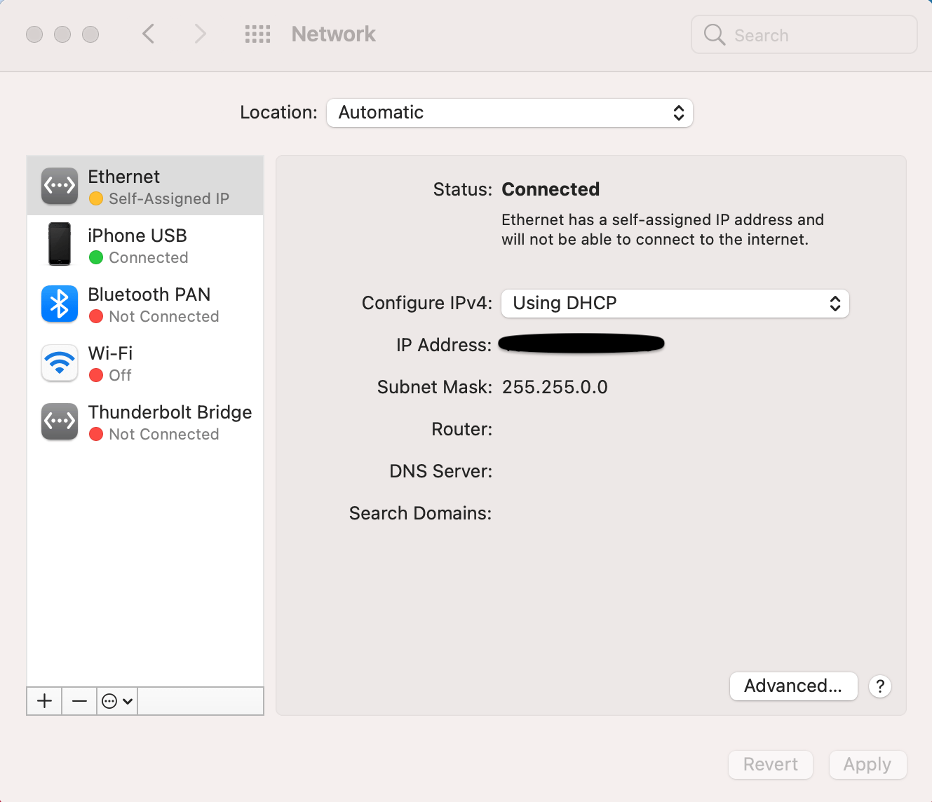 my mac has a self assigned ip address